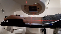 Radioterapia, nuovo acceleratore lineare per trattare i tumori