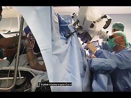 VIDEO Le straordinarie immagini dell'intervento di chirurgia da sveglio